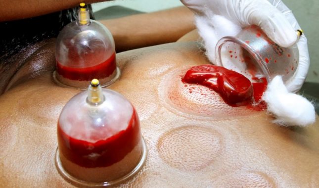 Bijelo Polje: Kažnjene sa po 400 i 500 eura zbog zbog bavljenja hidžamom