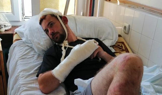 Brutalno pretučeni Bošnjaci u Bijelom Polju, uzrok napada nacionalna pripadnost? (VIDEO)