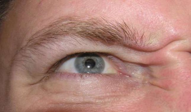 Zavidnost je oblik neprijateljstva prema Allahu