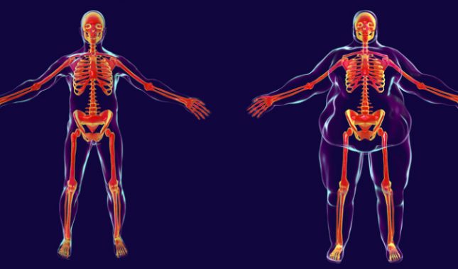 Pretilost-debljina-gojaznost