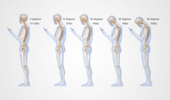 Ovako nepravilno korištenje mobitela utječe na vašu kičmu