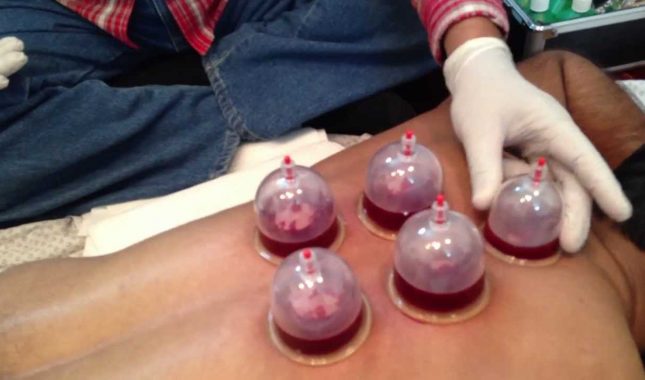 Šta hidžama liječi