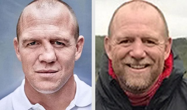Estetska operacija nosa, zabranjeno ili ne ?