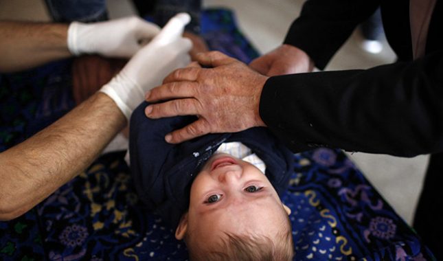 Obrezivanje djece i koristi sa naučnog aspekta