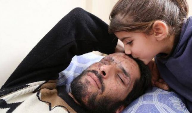 Apel djevojčice iz Sirije: Uzmite moje oči, dajte ih mom babi da me vidi, da me voli